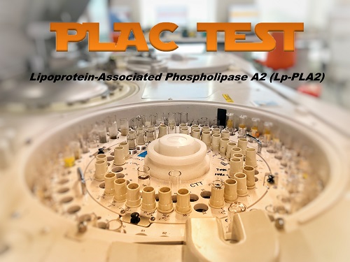 PLAC TEST (Lp- PLA2 Aktivitesi)